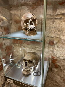 Rynek Underground Museum - pravděpodobně první operace mozku v Polsku